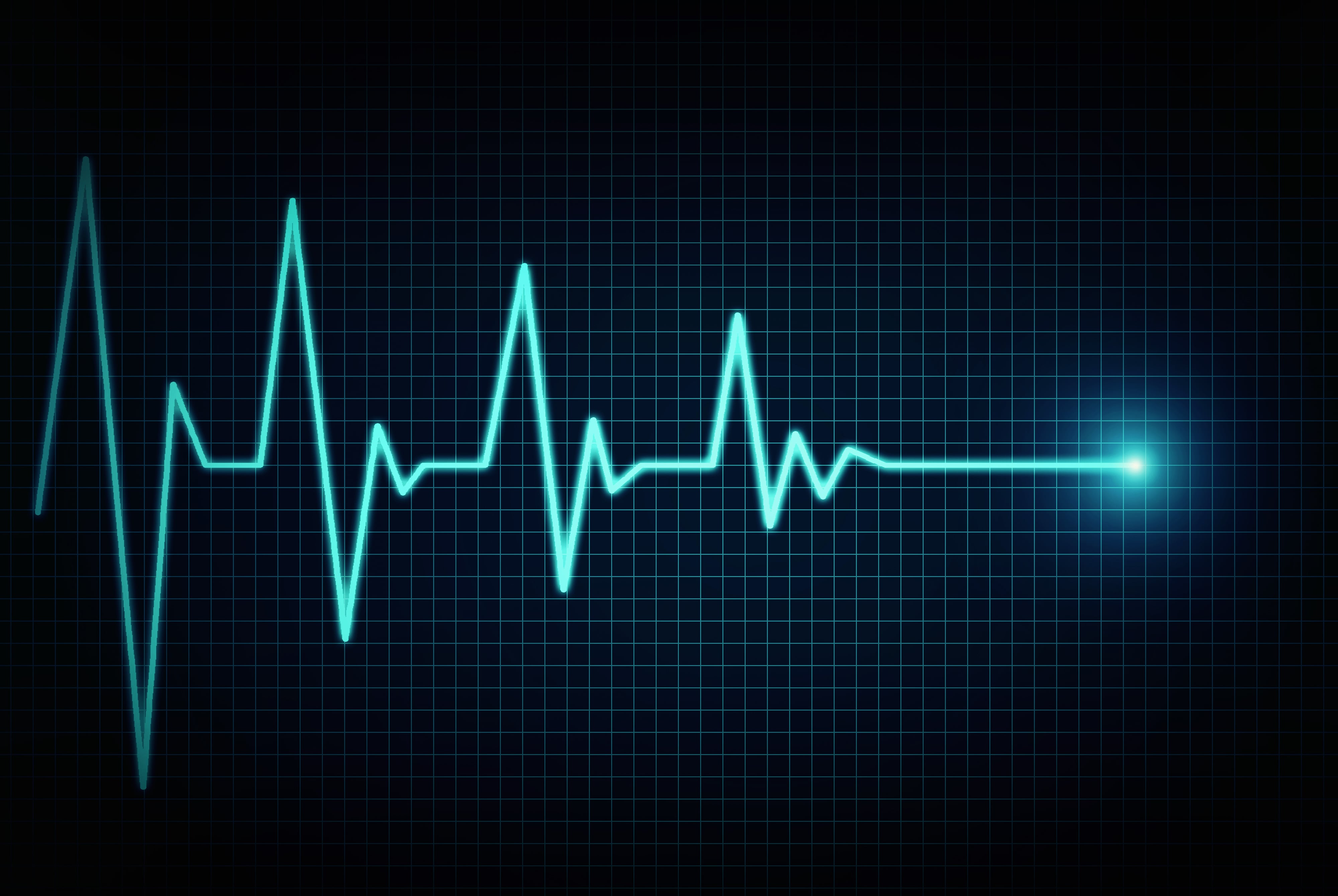 A heartbeat monitor pulse decreasing to a flatline.